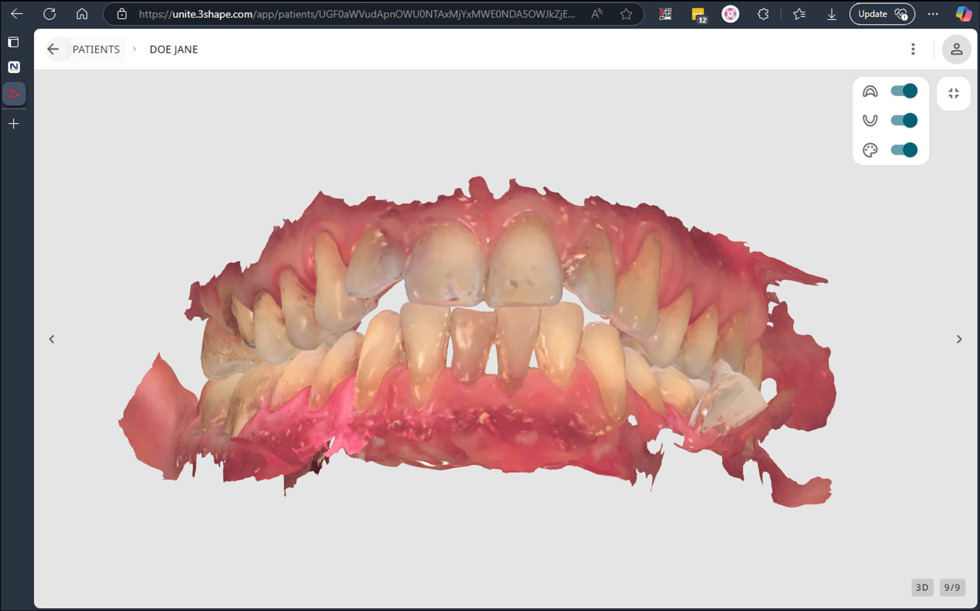 Easy access to scans from PMS - TRIOS_ (1)