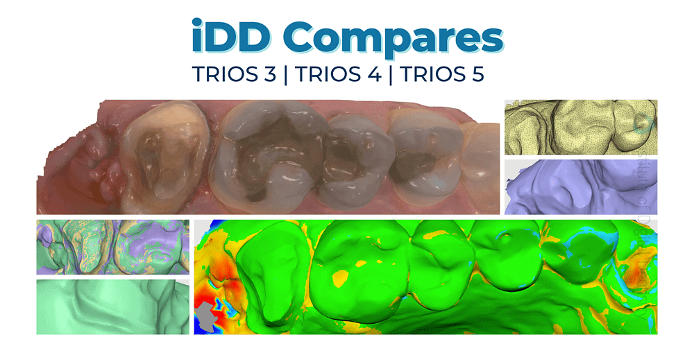 iDD-compares-blog-thumbnail-3shape-trios-intraoral-scanner